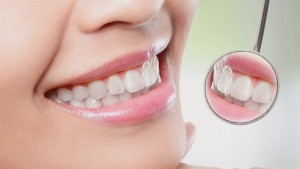 Dental Hygiene & Periodontal Care 1